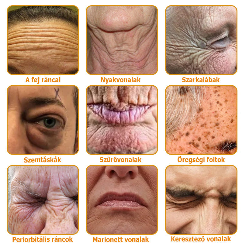 đšâđŹ AllyBeeÂź Botox BĆrĂĄpolĂł KrĂ©m RĂĄnctalanĂtĂĄs, HidratĂĄlĂĄs, BĆrregenerĂĄlĂĄs, Egyenletes BĆrtĂłnus, PattanĂĄs- Ă©s SötĂ©tfolt KezelĂ©s, Szemölcs- Ă©s Anyajegyek EltĂĄvolĂtĂĄsa