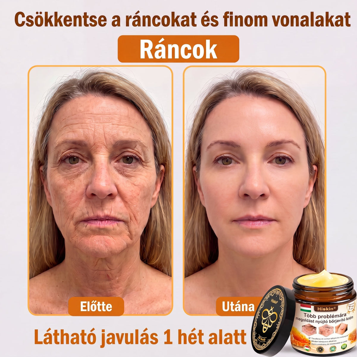 824匈牙利HISKIN® Multi-Concern Skin Repair Cream ✨ (One powerful cream to repair inflammation, dryness, aging, pigmentation, and visible skin damage.)