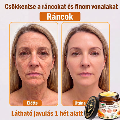 824匈牙利HISKIN® Multi-Concern Skin Repair Cream ✨ (One powerful cream to repair inflammation, dryness, aging, pigmentation, and visible skin damage.)