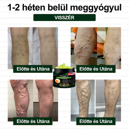 PLTOWE® Arnebia Ízületi és Csontfájdalom Enyhítő Krém (AAOS ajánlja)