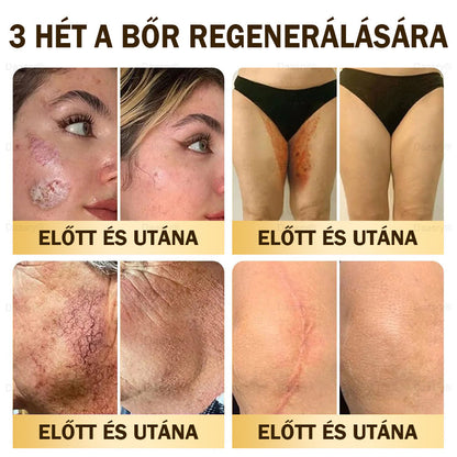 ⏳ Korlátozott ideig elérhető! Csak 3 doboz maradt! 🕔 Most akár 50% kedvezménnyel vásárolhatsz! 💥 Siess, és élvezd a megújulást még ma!