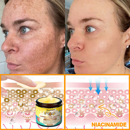 Daasry® Méhméreg Kezelő Krém, méhméreg peptidekkel, botulinum toxinnal, hialuronsavval és kollagénnel💧. Hatékonyan küzd a ráncok, finom vonalak, megereszkedés, terhességi csíkok és sötét foltok ellen — feszesítés, emelés és kiemelkedő eredmények!