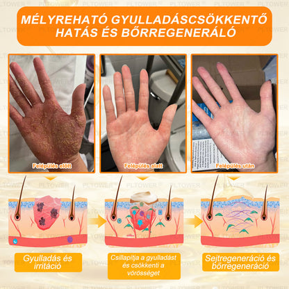 𝑼𝑺 𝑶𝒇𝒇𝒊𝒄𝒊𝒂𝒍 𝑺𝒕𝒐𝒓𝒆 | 𝐏𝐋𝑻𝑶𝗪𝗘® 𝐒𝐭𝐞𝒎 𝑪𝒆𝒍𝗹 & 𝗕𝗲𝗲 𝗩𝙚𝙣𝙤𝙢 𝘼𝙡𝙡-𝙞𝙣-𝐎𝐧𝐞 𝐒𝐤𝒊𝒏 𝑹𝒆𝒑𝒂𝒊𝒓 𝑪𝒓𝗲𝗮𝗺(𝐄𝐟𝐟𝐞𝐜𝐭𝐢𝐯𝐞 𝐖𝐢𝐭𝐡𝐢𝐧 𝟕 𝐃𝐚𝐲𝐬)𝐁𝐞𝐞 𝐕𝑒𝑛𝑜𝑚 + 𝗣𝗿𝗼𝗽𝗼𝗹𝗶𝘀 · 7𝑋 𝐷𝑒𝑒𝑝 𝐻𝑦𝑑𝑟𝑎𝑡𝑖𝒊𝒐𝒏, 𝒕𝒂𝒓𝒈𝒆𝒕𝒔 𝒘𝒓𝒊𝒏𝒌𝒍𝒆𝒔, 𝒔𝒂𝒈𝒈𝗴𝗶𝗻𝗴, 𝘀𝘁𝗿𝗲𝘁𝗰𝗵 𝗺𝗮𝗿𝗸𝘀, 𝗱𝗮𝗿𝗸 𝘀𝗽𝗼𝘁𝘀, 𝙥𝙪𝙧𝙥𝙪𝙧𝙖, 𝙞𝙣𝙛𝙡𝙖𝙢𝙢𝙖𝙩𝙞𝙤𝙣𝙨 𝙖𝙣𝙙 𝙢𝙤𝙧𝙚