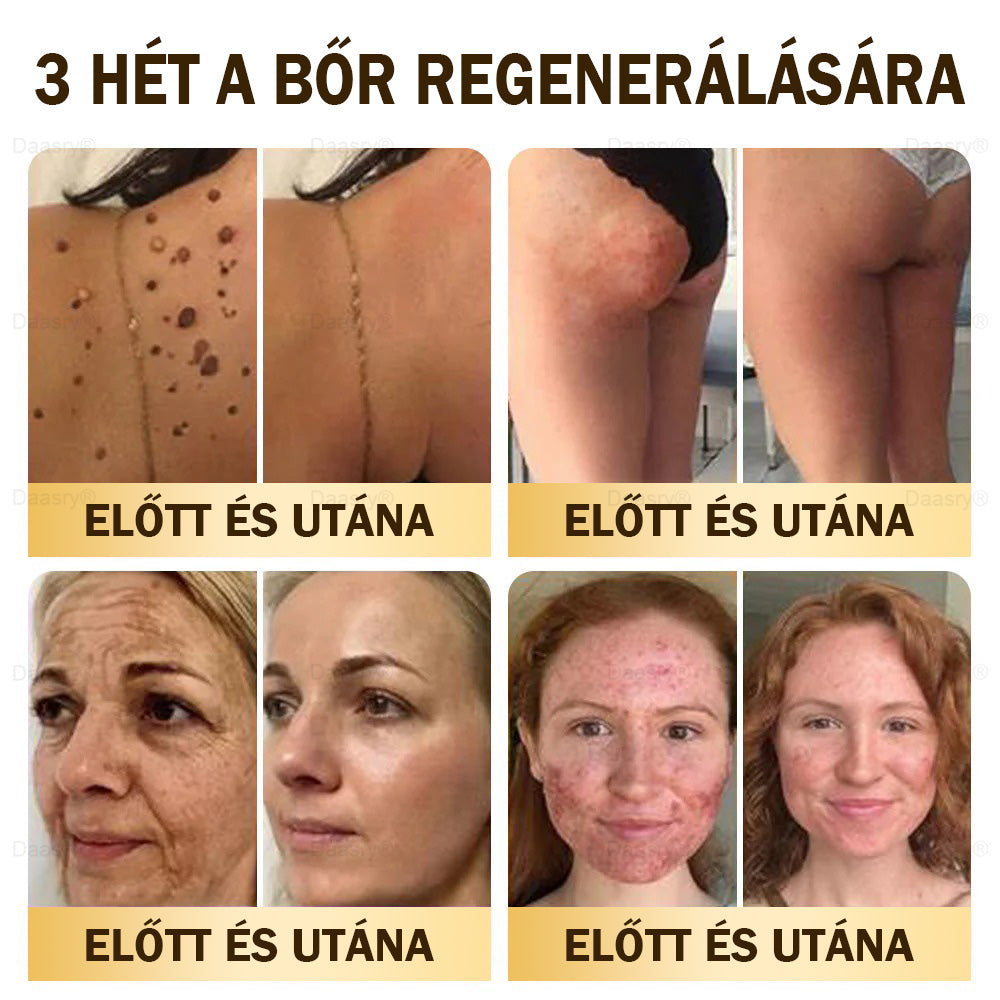 ⏳ Korlátozott ideig elérhető! Csak 3 doboz maradt! 🕔 Most akár 50% kedvezménnyel vásárolhatsz! 💥 Siess, és élvezd a megújulást még ma!