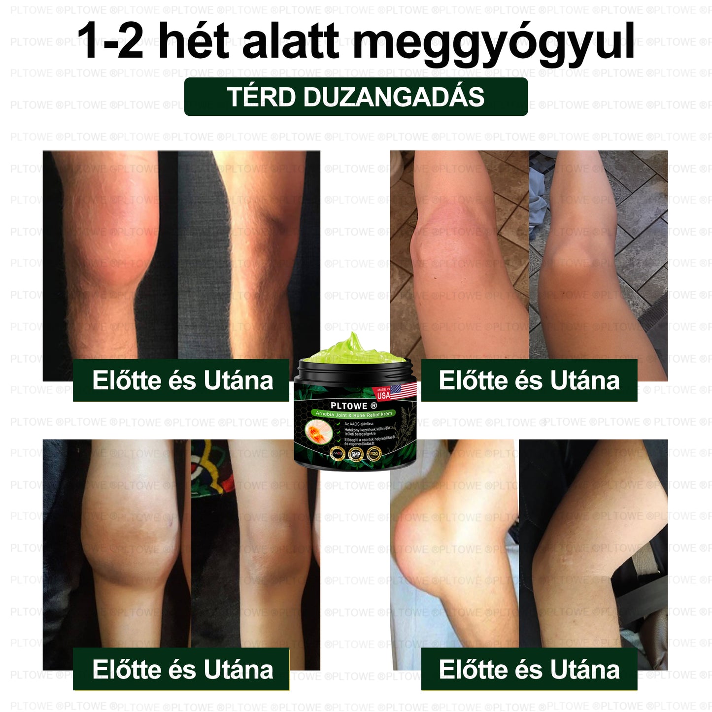 PLTOWE® Arnebia Ízületi és Csontfájdalom Enyhítő Krém (AAOS ajánlja)