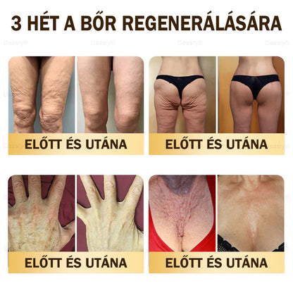 ⏳ Korlátozott ideig elérhető! Csak 3 doboz maradt! 🕔 Most akár 50% kedvezménnyel vásárolhatsz! 💥 Siess, és élvezd a megújulást még ma!