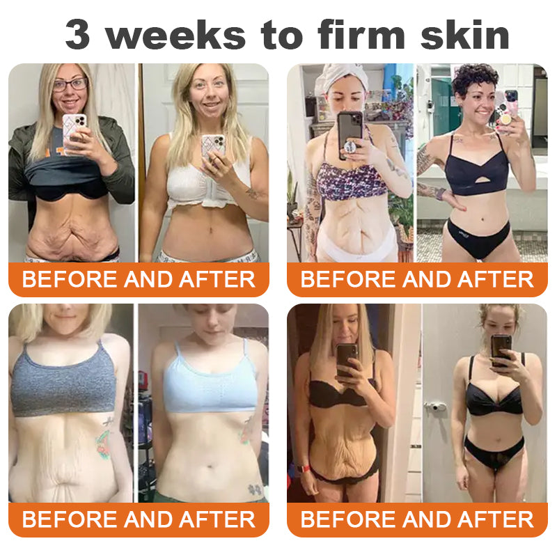 Made and Shipped from USA | | Allybee™ BOTOX Bee Venom All-in-one Treatment Cream | LAST DAY 80% OFF