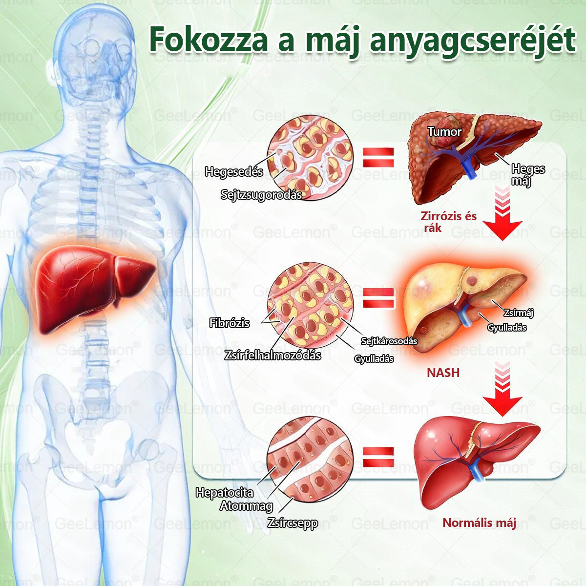 🎄Karácsonyi leárazás 🎄𝐆𝐞𝑒𝐿𝑒𝐦𝐨𝐧® Glumasetide 8 az 1-ben Karcsú és Egészséges Nano Mikrotűs Tapasz 🇭🇺✨✨