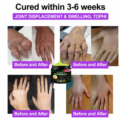 PLTOWE® Arnebia Joint and Bone Relief Cream(AAOS Recommends)