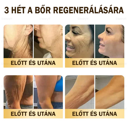 ⏳ Korlátozott ideig elérhető! Csak 3 doboz maradt! 🕔 Most akár 50% kedvezménnyel vásárolhatsz! 💥 Siess, és élvezd a megújulást még ma!