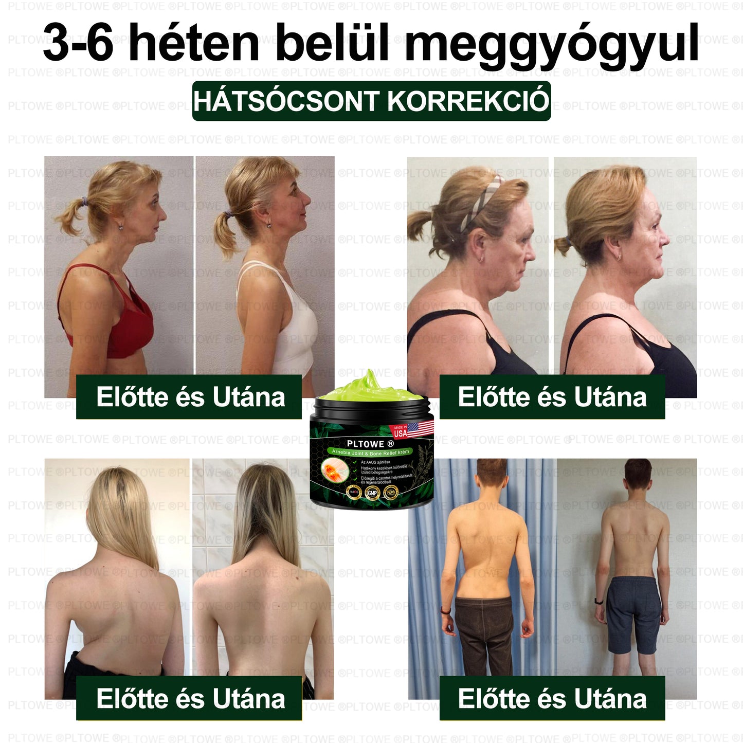 PLTOWE® Arnebia Ízületi és Csontfájdalom Enyhítő Krém (AAOS ajánlja)