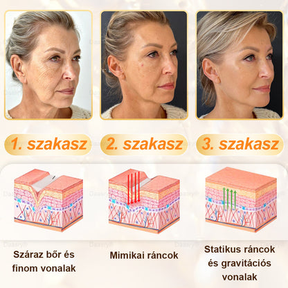 ⏳ Korlátozott ideig elérhető! Csak 3 doboz maradt! 🕔 Most akár 50% kedvezménnyel vásárolhatsz! 💥 Siess, és élvezd a megújulást még ma!