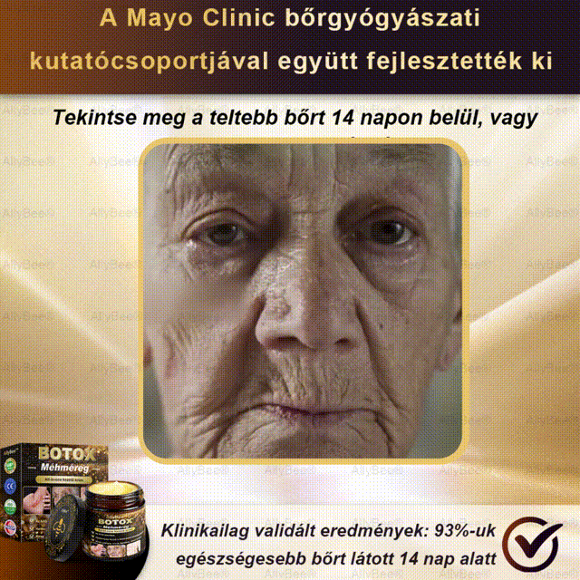 👨‍🔬 AllyBee® Botox Bőrápoló Krém Ránctalanítás, Hidratálás, Bőrregenerálás, Egyenletes Bőrtónus, Pattanás- és Sötétfolt Kezelés, Szemölcs- és Anyajegyek Eltávolítása