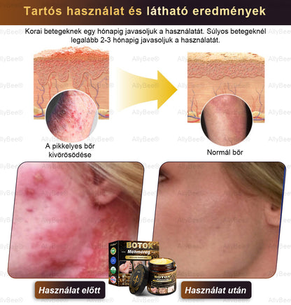 👨‍🔬 AllyBee® Botox Bőrápoló Krém Ránctalanítás, Hidratálás, Bőrregenerálás, Egyenletes Bőrtónus, Pattanás- és Sötétfolt Kezelés, Szemölcs- és Anyajegyek Eltávolítása