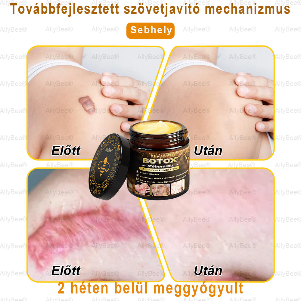 👨‍🔬 AllyBee® Botox Bőrápoló Krém Ránctalanítás, Hidratálás, Bőrregenerálás, Egyenletes Bőrtónus, Pattanás- és Sötétfolt Kezelés, Szemölcs- és Anyajegyek Eltávolítása