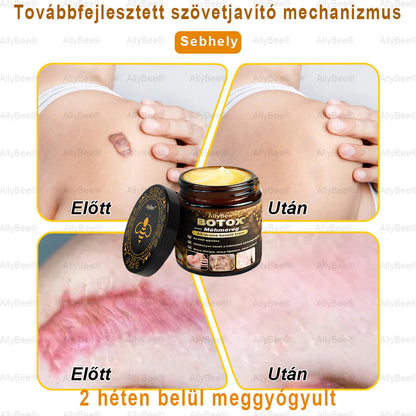 👨‍🔬 AllyBee® Botox Bőrápoló Krém Ránctalanítás, Hidratálás, Bőrregenerálás, Egyenletes Bőrtónus, Pattanás- és Sötétfolt Kezelés, Szemölcs- és Anyajegyek Eltávolítása
