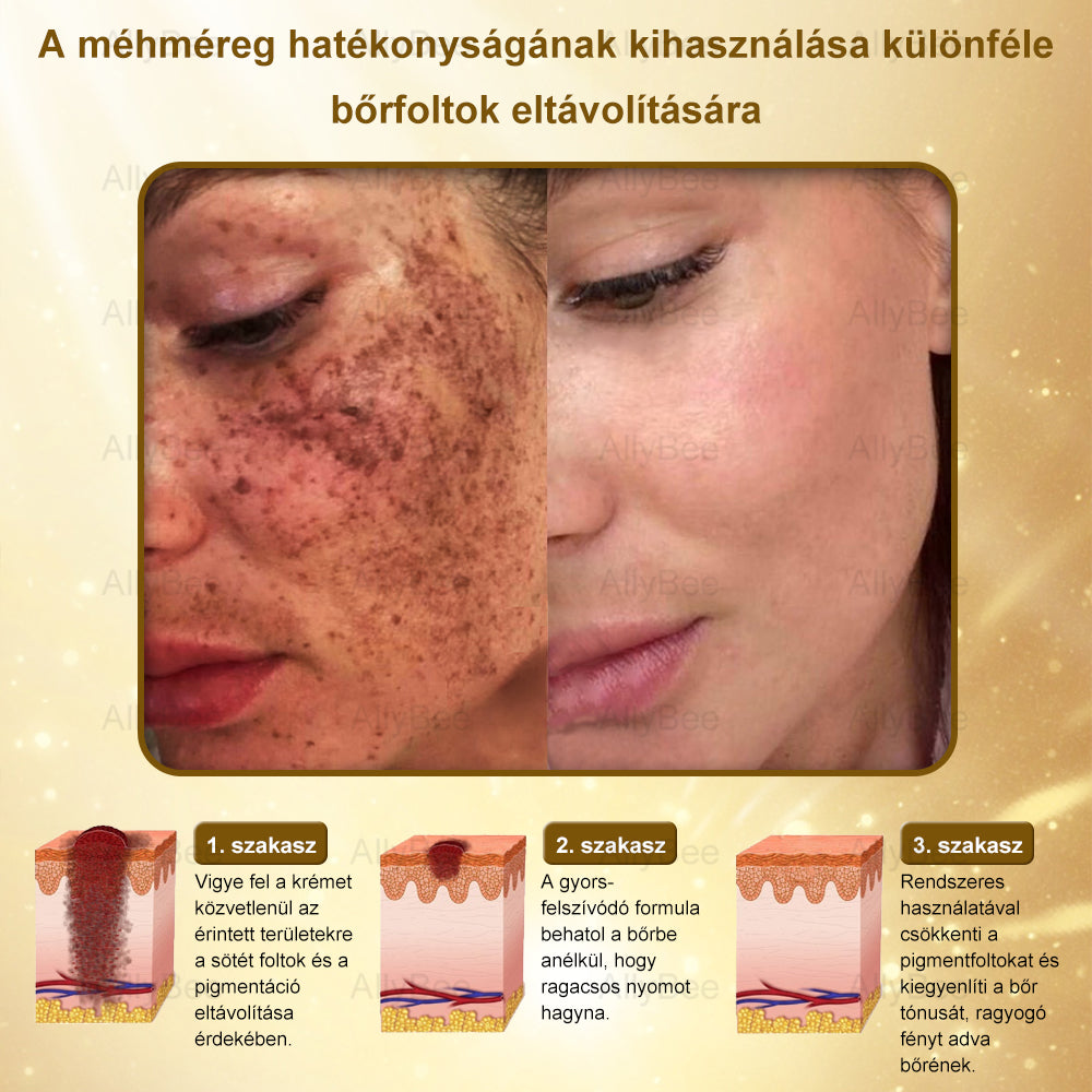 👨‍🔬 AllyBee® Botox Bőrápoló Krém Ránctalanítás, Hidratálás, Bőrregenerálás, Egyenletes Bőrtónus, Pattanás- és Sötétfolt Kezelés, Szemölcs- és Anyajegyek Eltávolítása