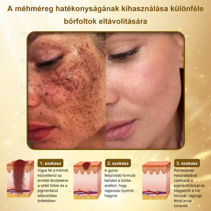 👨‍🔬 AllyBee® Botox Bőrápoló Krém Ránctalanítás, Hidratálás, Bőrregenerálás, Egyenletes Bőrtónus, Pattanás- és Sötétfolt Kezelés, Szemölcs- és Anyajegyek Eltávolítása