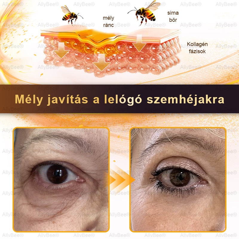 👨‍🔬 AllyBee® Botox Bőrápoló Krém Ránctalanítás, Hidratálás, Bőrregenerálás, Egyenletes Bőrtónus, Pattanás- és Sötétfolt Kezelés, Szemölcs- és Anyajegyek Eltávolítása