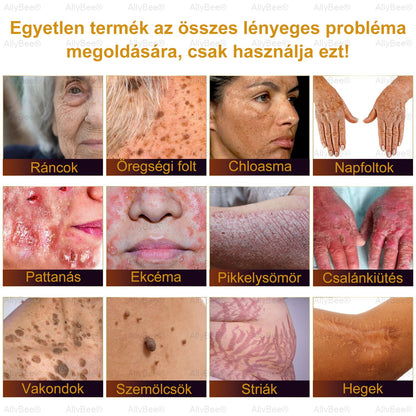 👨‍🔬 AllyBee® Botox Bőrápoló Krém Ránctalanítás, Hidratálás, Bőrregenerálás, Egyenletes Bőrtónus, Pattanás- és Sötétfolt Kezelés, Szemölcs- és Anyajegyek Eltávolítása