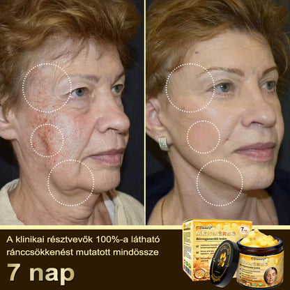 ⏳ Korlátozott ideig elérhető! Csak 3 doboz maradt! 🕔 Most akár 50% kedvezménnyel vásárolhatsz! 💥 Siess, és élvezd a megújulást még ma!