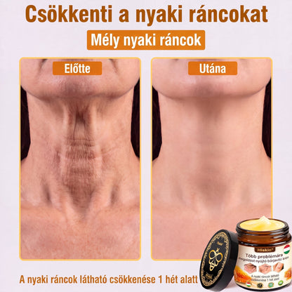 824匈牙利HISKIN® Multi-Concern Skin Repair Cream ✨ (One powerful cream to repair inflammation, dryness, aging, pigmentation, and visible skin damage.)