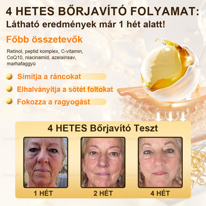 ⏳ Korlátozott ideig elérhető! Csak 3 doboz maradt! 🕔 Most akár 50% kedvezménnyel vásárolhatsz! 💥 Siess, és élvezd a megújulást még ma!