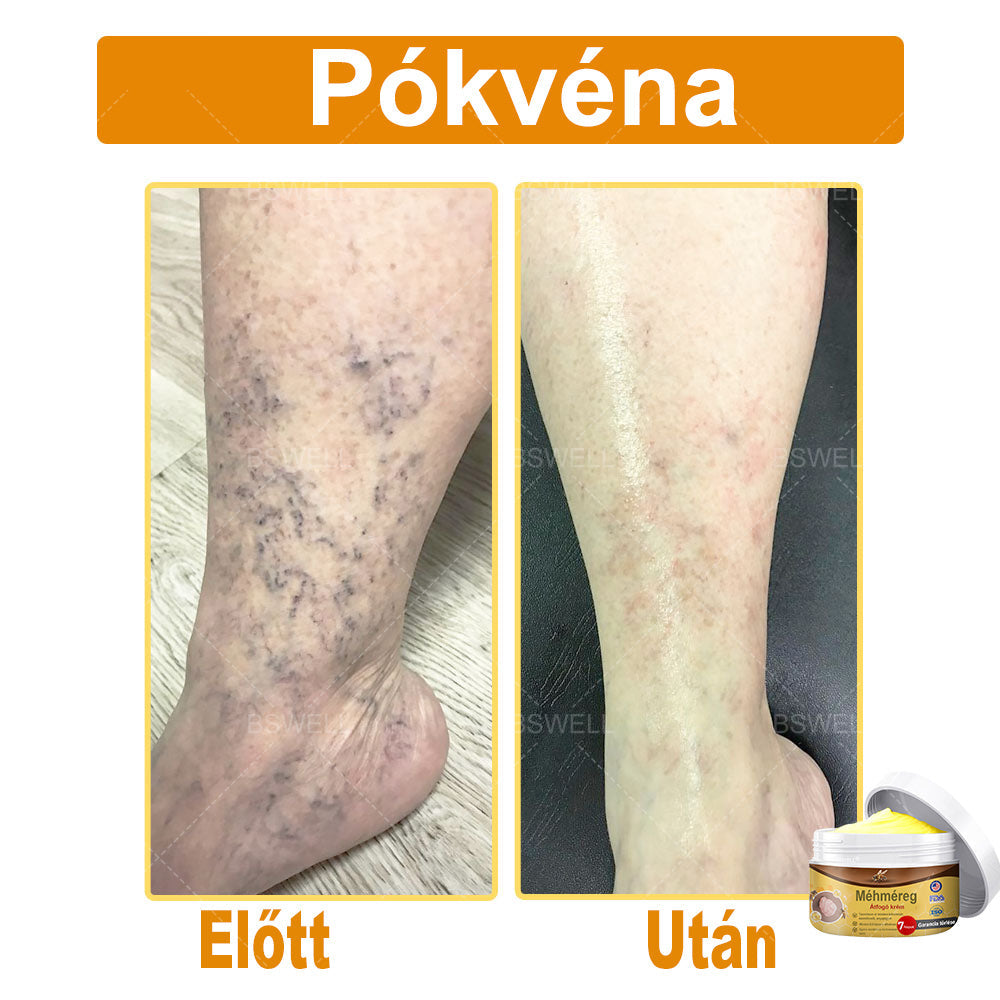 BSWELL® Méhméreg átfogó krém 🌿 AAD jóváhagyott és ajánlott