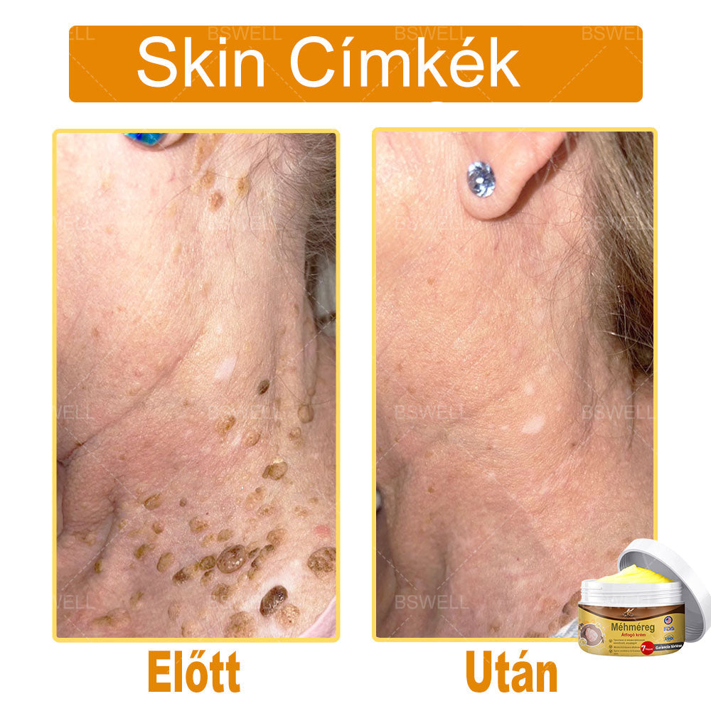 BSWELL® Méhméreg átfogó krém 🌿 AAD jóváhagyott és ajánlott