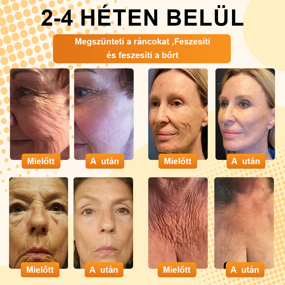 BSWELL® AgeDefy BeeSculpt Feszesítő Krém