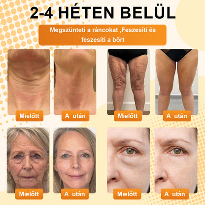 BSWELL® AgeDefy BeeSculpt Feszesítő Krém