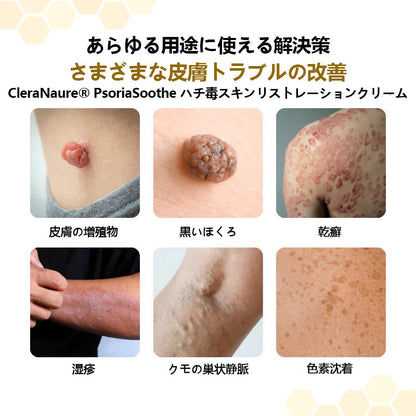 CleraNature® PsoriaSoothe 蜂毒配合スキンリジェネレーティングクリーム