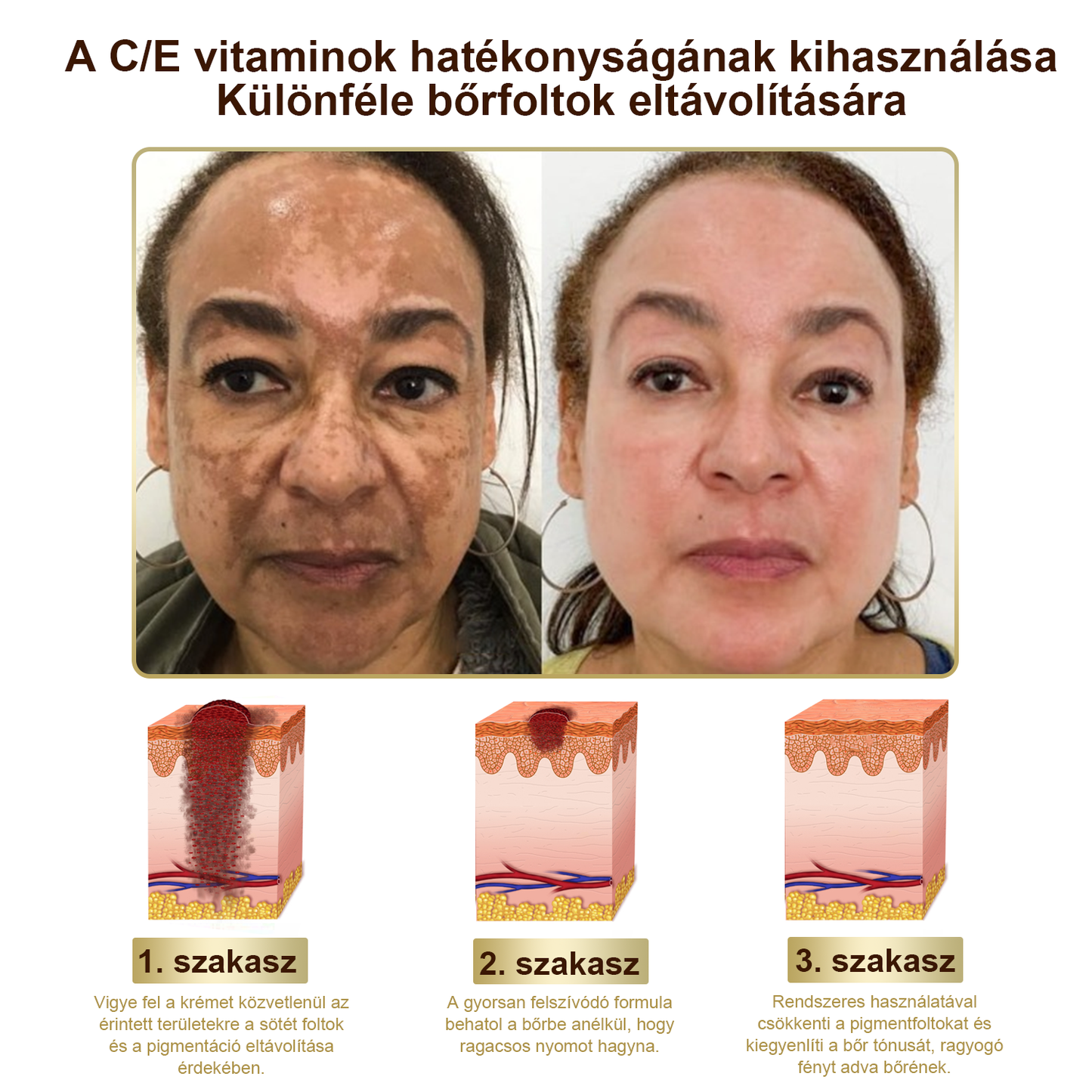 PLTOWE® Erőteljes egész testre ható bőrkezelő krém