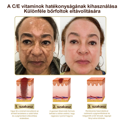 PLTOWE® Erőteljes egész testre ható bőrkezelő krém