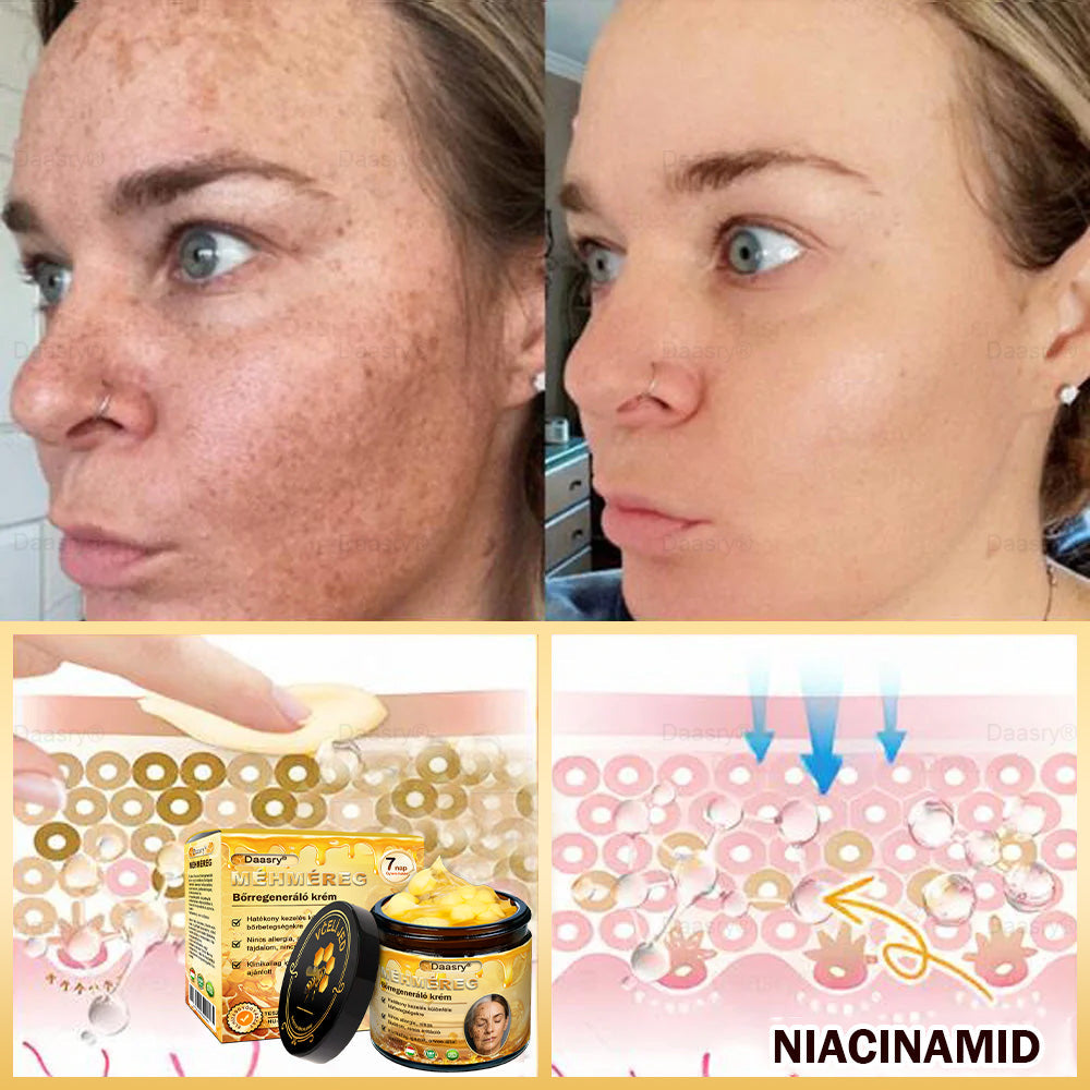 ⏳ Korlátozott ideig elérhető! Csak 3 doboz maradt! 🕔 Most akár 50% kedvezménnyel vásárolhatsz! 💥 Siess, és élvezd a megújulást még ma!