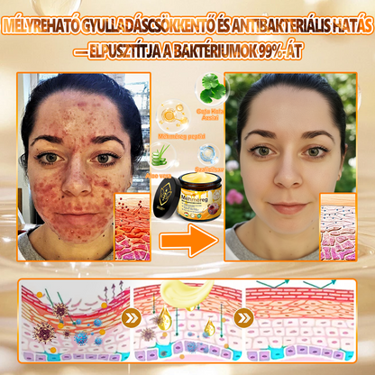 𝑫𝒂𝒂𝘀𝗿𝘆® 8-𝗮𝘇-𝟭-𝒃𝒆𝒏 𝑴é𝒉𝒎é𝒓𝒆𝒈 & 𝑭𝒂𝒈𝒈𝒚ú 𝑩ő𝒓𝒇𝒆𝒔𝒛𝒆𝒔í𝒕ő é𝒔 𝑹𝒆𝒈𝒆𝒏𝒆𝒓á𝒍ó 𝑲𝒓é𝒎