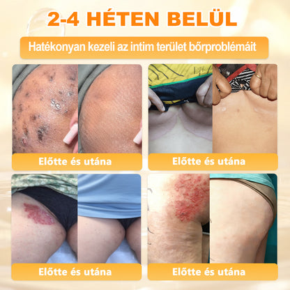 𝑫𝒂𝒂𝘀𝗿𝘆® 8-𝗮𝘇-𝟭-𝒃𝒆𝒏 𝑴é𝒉𝒎é𝒓𝒆𝒈 & 𝑭𝒂𝒈𝒈𝒚ú 𝑩ő𝒓𝒇𝒆𝒔𝒛𝒆𝒔í𝒕ő é𝒔 𝑹𝒆𝒈𝒆𝒏𝒆𝒓á𝒍ó 𝑲𝒓é𝒎