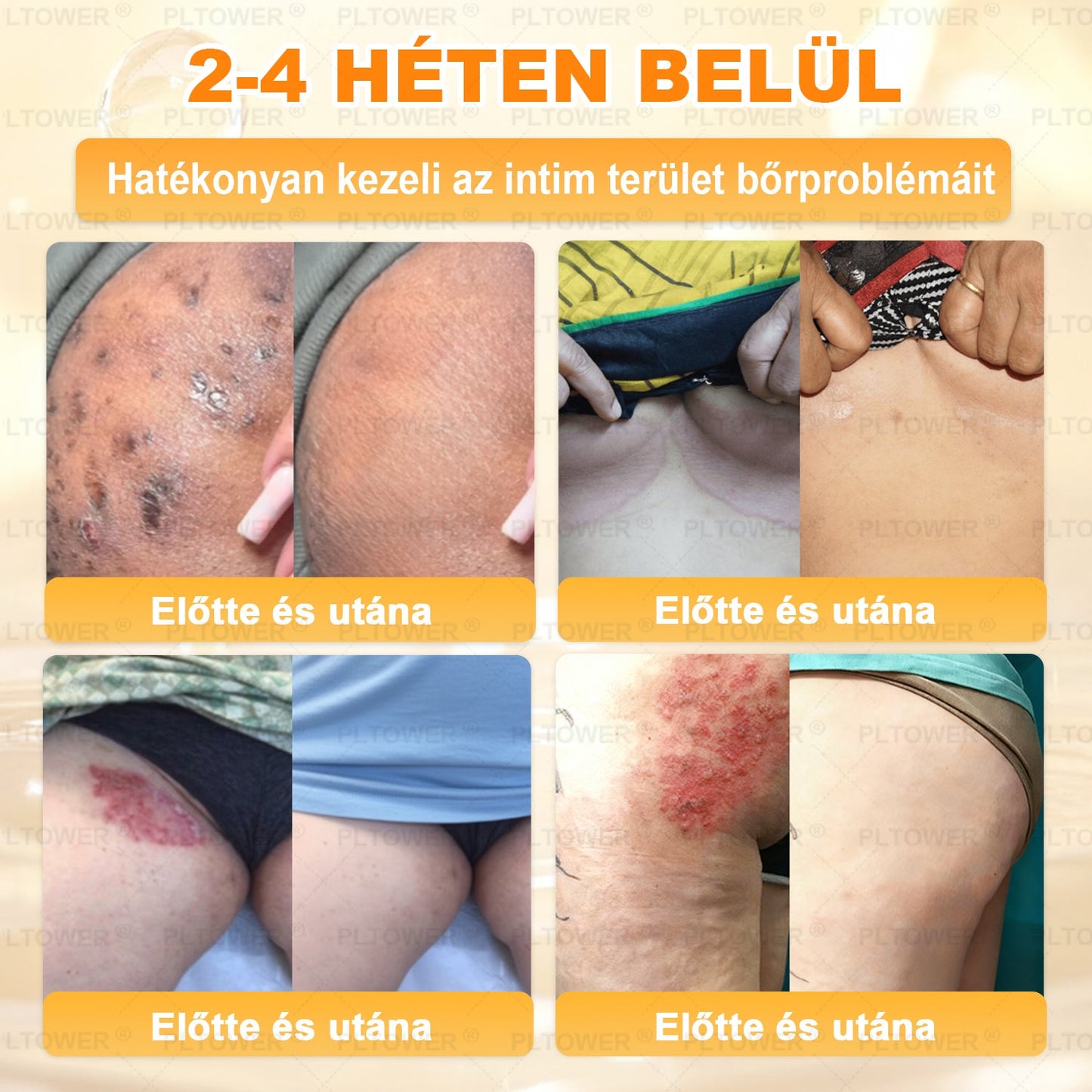 𝑼𝑺 𝑶𝒇𝒇𝒊𝒄𝒊𝒂𝒍 𝑺𝒕𝒐𝒓𝒆 | 𝐏𝐋𝑻𝑶𝗪𝗘® 𝐒𝐭𝐞𝒎 𝑪𝒆𝒍𝗹 & 𝗕𝗲𝗲 𝗩𝙚𝙣𝙤𝙢 𝘼𝙡𝙡-𝙞𝙣-𝐎𝐧𝐞 𝐒𝐤𝒊𝒏 𝑹𝒆𝒑𝒂𝒊𝒓 𝑪𝒓𝗲𝗮𝗺(𝐄𝐟𝐟𝐞𝐜𝐭𝐢𝐯𝐞 𝐖𝐢𝐭𝐡𝐢𝐧 𝟕 𝐃𝐚𝐲𝐬)𝐁𝐞𝐞 𝐕𝑒𝑛𝑜𝑚 + 𝗣𝗿𝗼𝗽𝗼𝗹𝗶𝘀 · 7𝑋 𝐷𝑒𝑒𝑝 𝐻𝑦𝑑𝑟𝑎𝑡𝑖𝒊𝒐𝒏, 𝒕𝒂𝒓𝒈𝒆𝒕𝒔 𝒘𝒓𝒊𝒏𝒌𝒍𝒆𝒔, 𝒔𝒂𝒈𝒈𝗴𝗶𝗻𝗴, 𝘀𝘁𝗿𝗲𝘁𝗰𝗵 𝗺𝗮𝗿𝗸𝘀, 𝗱𝗮𝗿𝗸 𝘀𝗽𝗼𝘁𝘀, 𝙥𝙪𝙧𝙥𝙪𝙧𝙖, 𝙞𝙣𝙛𝙡𝙖𝙢𝙢𝙖𝙩𝙞𝙤𝙣𝙨 𝙖𝙣𝙙 𝙢𝙤𝙧𝙚