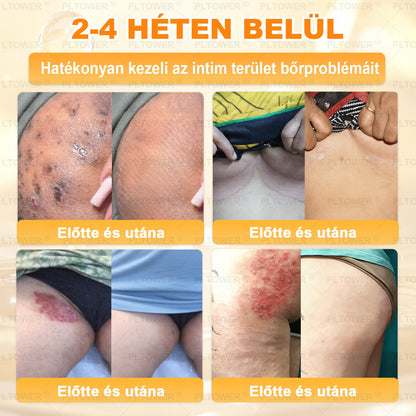 𝑼𝑺 𝑶𝒇𝒇𝒊𝒄𝒊𝒂𝒍 𝑺𝒕𝒐𝒓𝒆 | 𝐏𝐋𝑻𝑶𝗪𝗘® 𝐒𝐭𝐞𝒎 𝑪𝒆𝒍𝗹 & 𝗕𝗲𝗲 𝗩𝙚𝙣𝙤𝙢 𝘼𝙡𝙡-𝙞𝙣-𝐎𝐧𝐞 𝐒𝐤𝒊𝒏 𝑹𝒆𝒑𝒂𝒊𝒓 𝑪𝒓𝗲𝗮𝗺(𝐄𝐟𝐟𝐞𝐜𝐭𝐢𝐯𝐞 𝐖𝐢𝐭𝐡𝐢𝐧 𝟕 𝐃𝐚𝐲𝐬)𝐁𝐞𝐞 𝐕𝑒𝑛𝑜𝑚 + 𝗣𝗿𝗼𝗽𝗼𝗹𝗶𝘀 · 7𝑋 𝐷𝑒𝑒𝑝 𝐻𝑦𝑑𝑟𝑎𝑡𝑖𝒊𝒐𝒏, 𝒕𝒂𝒓𝒈𝒆𝒕𝒔 𝒘𝒓𝒊𝒏𝒌𝒍𝒆𝒔, 𝒔𝒂𝒈𝒈𝗴𝗶𝗻𝗴, 𝘀𝘁𝗿𝗲𝘁𝗰𝗵 𝗺𝗮𝗿𝗸𝘀, 𝗱𝗮𝗿𝗸 𝘀𝗽𝗼𝘁𝘀, 𝙥𝙪𝙧𝙥𝙪𝙧𝙖, 𝙞𝙣𝙛𝙡𝙖𝙢𝙢𝙖𝙩𝙞𝙤𝙣𝙨 𝙖𝙣𝙙 𝙢𝙤𝙧𝙚