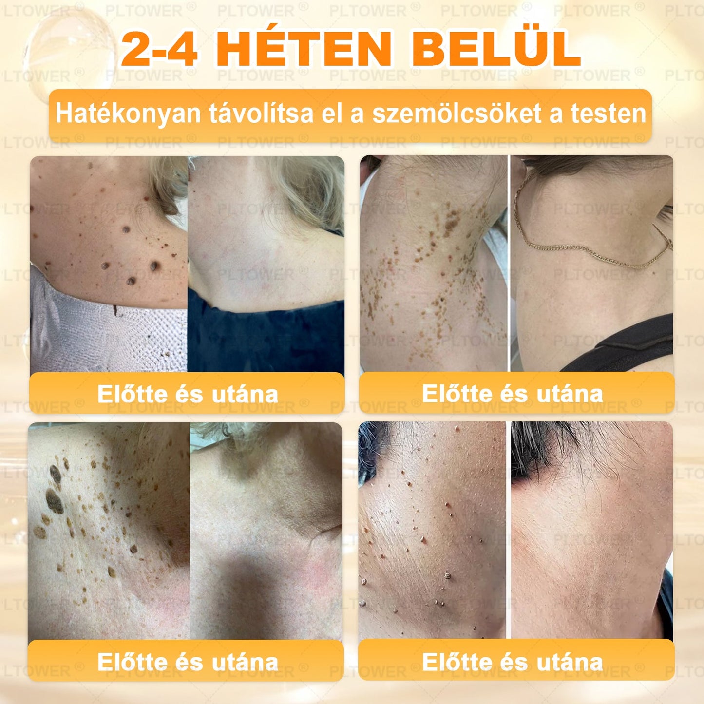 𝑼𝑺 𝑶𝒇𝒇𝒊𝒄𝒊𝒂𝒍 𝑺𝒕𝒐𝒓𝒆 | 𝐏𝐋𝑻𝑶𝗪𝗘® 𝐒𝐭𝐞𝒎 𝑪𝒆𝒍𝗹 & 𝗕𝗲𝗲 𝗩𝙚𝙣𝙤𝙢 𝘼𝙡𝙡-𝙞𝙣-𝐎𝐧𝐞 𝐒𝐤𝒊𝒏 𝑹𝒆𝒑𝒂𝒊𝒓 𝑪𝒓𝗲𝗮𝗺(𝐄𝐟𝐟𝐞𝐜𝐭𝐢𝐯𝐞 𝐖𝐢𝐭𝐡𝐢𝐧 𝟕 𝐃𝐚𝐲𝐬)𝐁𝐞𝐞 𝐕𝑒𝑛𝑜𝑚 + 𝗣𝗿𝗼𝗽𝗼𝗹𝗶𝘀 · 7𝑋 𝐷𝑒𝑒𝑝 𝐻𝑦𝑑𝑟𝑎𝑡𝑖𝒊𝒐𝒏, 𝒕𝒂𝒓𝒈𝒆𝒕𝒔 𝒘𝒓𝒊𝒏𝒌𝒍𝒆𝒔, 𝒔𝒂𝒈𝒈𝗴𝗶𝗻𝗴, 𝘀𝘁𝗿𝗲𝘁𝗰𝗵 𝗺𝗮𝗿𝗸𝘀, 𝗱𝗮𝗿𝗸 𝘀𝗽𝗼𝘁𝘀, 𝙥𝙪𝙧𝙥𝙪𝙧𝙖, 𝙞𝙣𝙛𝙡𝙖𝙢𝙢𝙖𝙩𝙞𝙤𝙣𝙨 𝙖𝙣𝙙 𝙢𝙤𝙧𝙚
