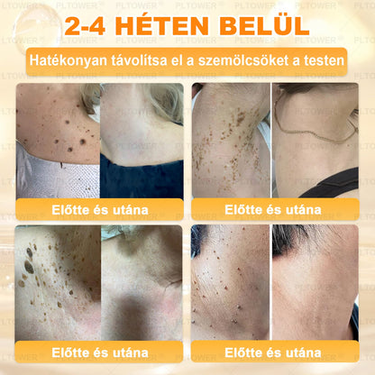 𝑼𝑺 𝑶𝒇𝒇𝒊𝒄𝒊𝒂𝒍 𝑺𝒕𝒐𝒓𝒆 | 𝐏𝐋𝑻𝑶𝗪𝗘® 𝐒𝐭𝐞𝒎 𝑪𝒆𝒍𝗹 & 𝗕𝗲𝗲 𝗩𝙚𝙣𝙤𝙢 𝘼𝙡𝙡-𝙞𝙣-𝐎𝐧𝐞 𝐒𝐤𝒊𝒏 𝑹𝒆𝒑𝒂𝒊𝒓 𝑪𝒓𝗲𝗮𝗺(𝐄𝐟𝐟𝐞𝐜𝐭𝐢𝐯𝐞 𝐖𝐢𝐭𝐡𝐢𝐧 𝟕 𝐃𝐚𝐲𝐬)𝐁𝐞𝐞 𝐕𝑒𝑛𝑜𝑚 + 𝗣𝗿𝗼𝗽𝗼𝗹𝗶𝘀 · 7𝑋 𝐷𝑒𝑒𝑝 𝐻𝑦𝑑𝑟𝑎𝑡𝑖𝒊𝒐𝒏, 𝒕𝒂𝒓𝒈𝒆𝒕𝒔 𝒘𝒓𝒊𝒏𝒌𝒍𝒆𝒔, 𝒔𝒂𝒈𝒈𝗴𝗶𝗻𝗴, 𝘀𝘁𝗿𝗲𝘁𝗰𝗵 𝗺𝗮𝗿𝗸𝘀, 𝗱𝗮𝗿𝗸 𝘀𝗽𝗼𝘁𝘀, 𝙥𝙪𝙧𝙥𝙪𝙧𝙖, 𝙞𝙣𝙛𝙡𝙖𝙢𝙢𝙖𝙩𝙞𝙤𝙣𝙨 𝙖𝙣𝙙 𝙢𝙤𝙧𝙚