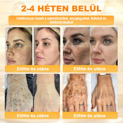 𝑼𝑺 𝑶𝒇𝒇𝒊𝒄𝒊𝒂𝒍 𝑺𝒕𝒐𝒓𝒆 | 𝐏𝐋𝑻𝑶𝗪𝗘® 𝐒𝐭𝐞𝒎 𝑪𝒆𝒍𝗹 & 𝗕𝗲𝗲 𝗩𝙚𝙣𝙤𝙢 𝘼𝙡𝙡-𝙞𝙣-𝐎𝐧𝐞 𝐒𝐤𝒊𝒏 𝑹𝒆𝒑𝒂𝒊𝒓 𝑪𝒓𝗲𝗮𝗺(𝐄𝐟𝐟𝐞𝐜𝐭𝐢𝐯𝐞 𝐖𝐢𝐭𝐡𝐢𝐧 𝟕 𝐃𝐚𝐲𝐬)𝐁𝐞𝐞 𝐕𝑒𝑛𝑜𝑚 + 𝗣𝗿𝗼𝗽𝗼𝗹𝗶𝘀 · 7𝑋 𝐷𝑒𝑒𝑝 𝐻𝑦𝑑𝑟𝑎𝑡𝑖𝒊𝒐𝒏, 𝒕𝒂𝒓𝒈𝒆𝒕𝒔 𝒘𝒓𝒊𝒏𝒌𝒍𝒆𝒔, 𝒔𝒂𝒈𝒈𝗴𝗶𝗻𝗴, 𝘀𝘁𝗿𝗲𝘁𝗰𝗵 𝗺𝗮𝗿𝗸𝘀, 𝗱𝗮𝗿𝗸 𝘀𝗽𝗼𝘁𝘀, 𝙥𝙪𝙧𝙥𝙪𝙧𝙖, 𝙞𝙣𝙛𝙡𝙖𝙢𝙢𝙖𝙩𝙞𝙤𝙣𝙨 𝙖𝙣𝙙 𝙢𝙤𝙧𝙚