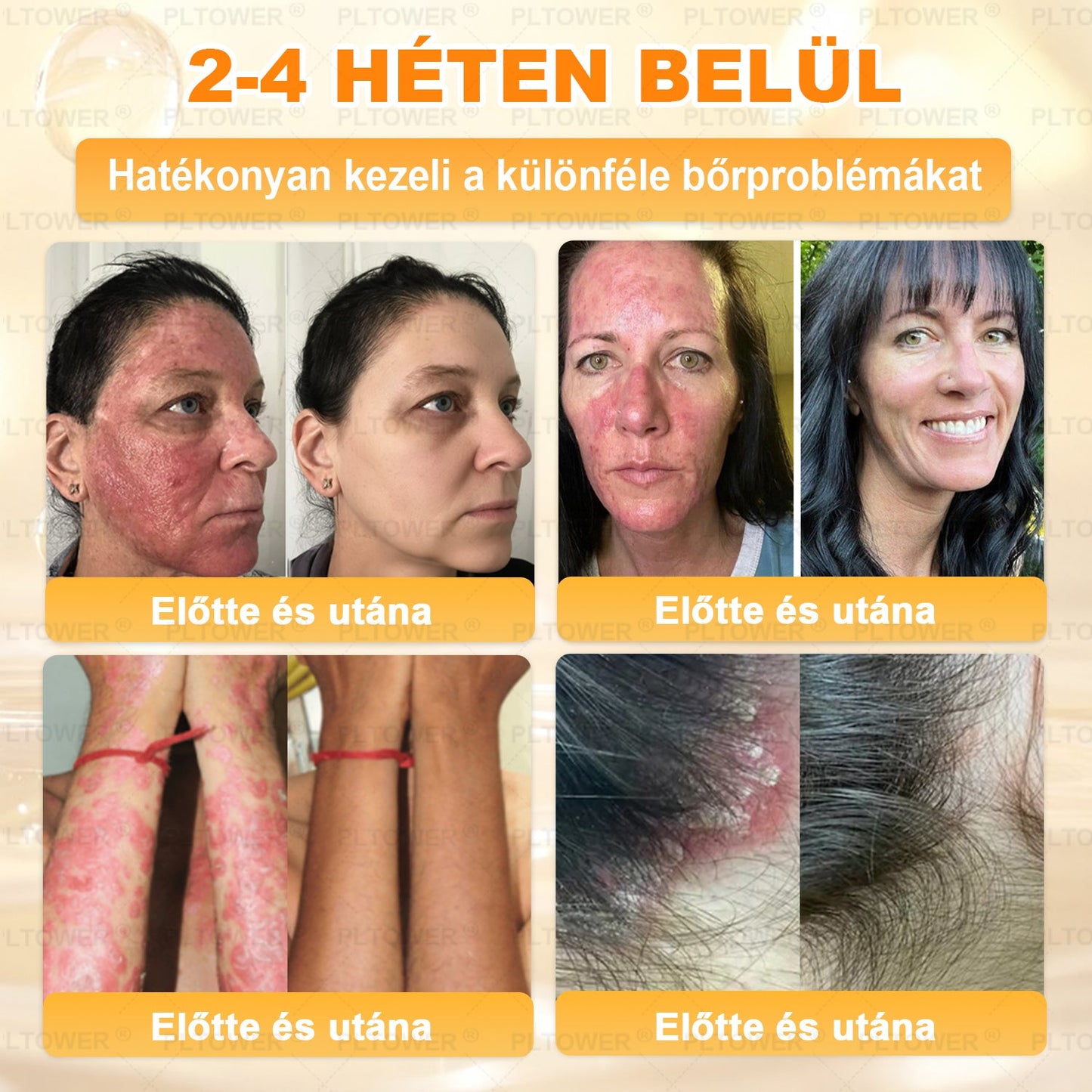 𝑼𝑺 𝑶𝒇𝒇𝒊𝒄𝒊𝒂𝒍 𝑺𝒕𝒐𝒓𝒆 | 𝐏𝐋𝑻𝑶𝗪𝗘® 𝐒𝐭𝐞𝒎 𝑪𝒆𝒍𝗹 & 𝗕𝗲𝗲 𝗩𝙚𝙣𝙤𝙢 𝘼𝙡𝙡-𝙞𝙣-𝐎𝐧𝐞 𝐒𝐤𝒊𝒏 𝑹𝒆𝒑𝒂𝒊𝒓 𝑪𝒓𝗲𝗮𝗺(𝐄𝐟𝐟𝐞𝐜𝐭𝐢𝐯𝐞 𝐖𝐢𝐭𝐡𝐢𝐧 𝟕 𝐃𝐚𝐲𝐬)𝐁𝐞𝐞 𝐕𝑒𝑛𝑜𝑚 + 𝗣𝗿𝗼𝗽𝗼𝗹𝗶𝘀 · 7𝑋 𝐷𝑒𝑒𝑝 𝐻𝑦𝑑𝑟𝑎𝑡𝑖𝒊𝒐𝒏, 𝒕𝒂𝒓𝒈𝒆𝒕𝒔 𝒘𝒓𝒊𝒏𝒌𝒍𝒆𝒔, 𝒔𝒂𝒈𝒈𝗴𝗶𝗻𝗴, 𝘀𝘁𝗿𝗲𝘁𝗰𝗵 𝗺𝗮𝗿𝗸𝘀, 𝗱𝗮𝗿𝗸 𝘀𝗽𝗼𝘁𝘀, 𝙥𝙪𝙧𝙥𝙪𝙧𝙖, 𝙞𝙣𝙛𝙡𝙖𝙢𝙢𝙖𝙩𝙞𝙤𝙣𝙨 𝙖𝙣𝙙 𝙢𝙤𝙧𝙚